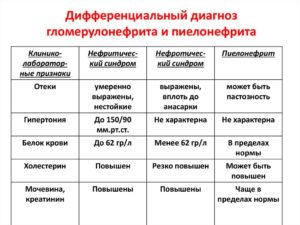 Дифференциальная диагностика гломерулонефрита у детей