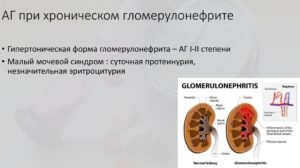 Артериальная гипертензия при хроническом гломерулонефрите