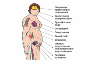 Надпочечники симптомы заболевания у мужчин диагностика и лечение