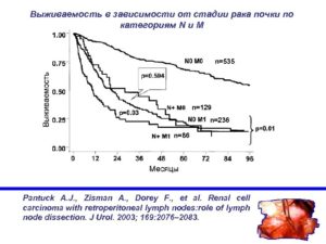 Пятилетняя выживаемость при раке почки