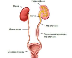 Как устроены почки и мочеточники