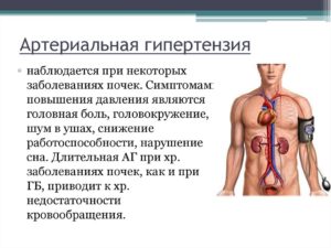 Почечная давление признаки