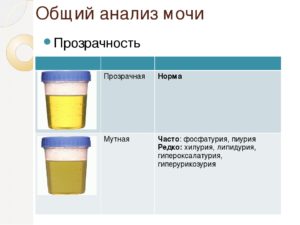 Моча как вода прозрачная что означает