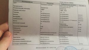 Почему может быть плохая моча