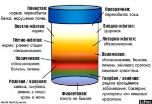 Отличается ли моча женщины от мочи мужчины