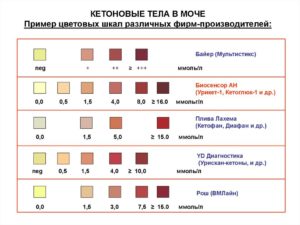 Кетоновые тела в моче у ребенка что это значит