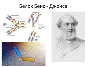 Белок бенс джонса