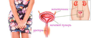 Боли в мочеиспускательном канале у женщин причины