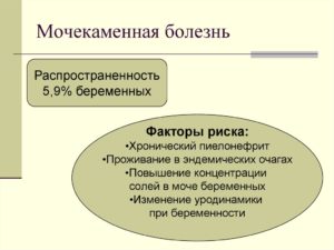 Факторы риска при мочекаменной болезни