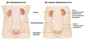 Где находятся почки во время беременности