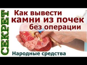 Чем можно вывести камень из почек