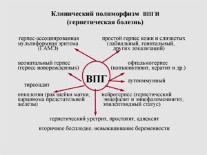 Уретрит от герпеса