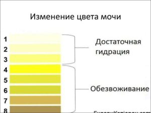 Моча темно желтого цвета у мужчин