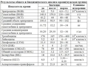 Как обозначается мочевина в биохимическом анализе крови