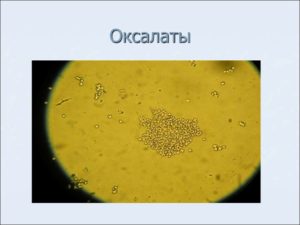 Что такое оксалаты