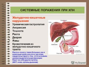 При рвоте и поносе болят почки