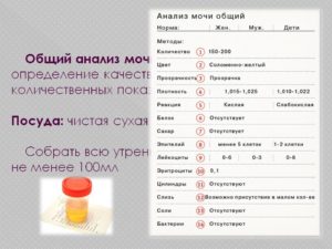 Сколько миллилитров мочи нужно для анализа общего