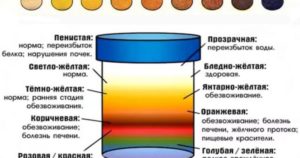 Моча цвета чая почему