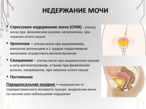 Беременность недержание мочи при кашле