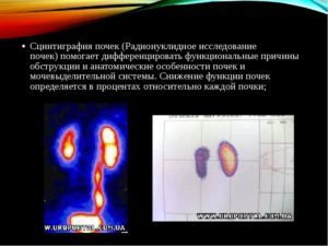 Сцинтиграфия почек в москве детям