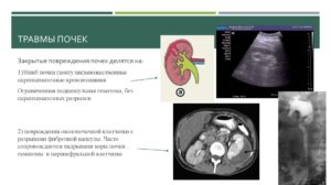 Симптомы при отбитых почках у ребенка