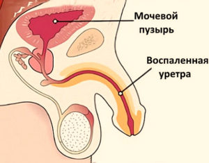 Зуд в уретре у мужчин