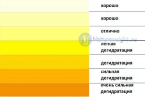 Почему моча лимонного цвета