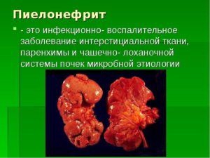 Самые тяжелые заболевания почек