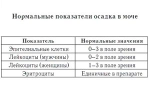 Эпителий плоский в моче норма у мужчин