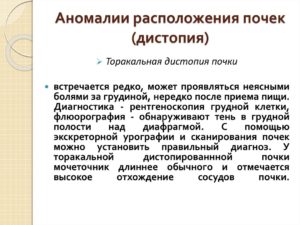 Аномалии расположения почек дистопия