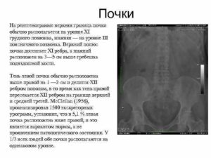 Почка на уровне подвздошной кости