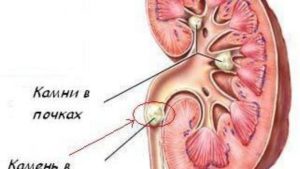 Протоки в почках