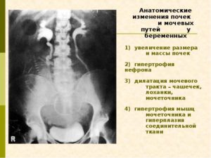 Беременность у ребенка увеличены почки