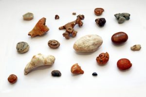 Камни в почках лечение народная медицина