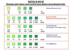 Много белка в моче у беременной