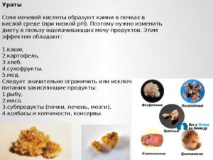 Соль в почках что можно кушать