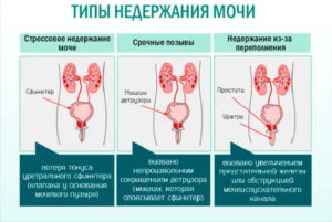 Причины недержание мочи ночью у мужчин причины