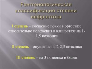 Нефроптоз классификация клиника диагностика лечение