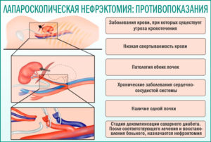 Препараты после удаления почки