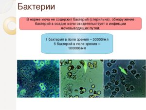 Бактерии в моче при беременности причины и лечение