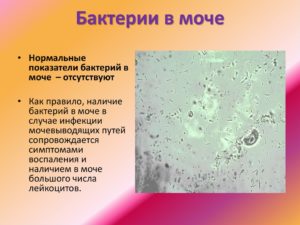Лекарство от бактерий в моче