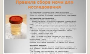 Какое количество мочи достаточно для анализа