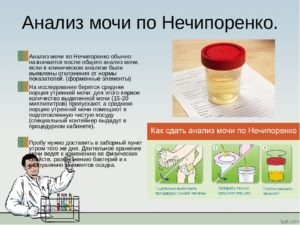 Почему анализ мочи сдают утром