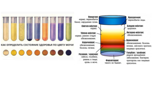 Моча при заболевании почек