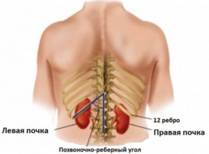 Правая почка где находится и как болит