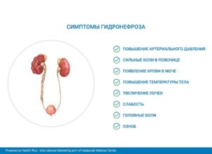 Увеличены почки у мужчины