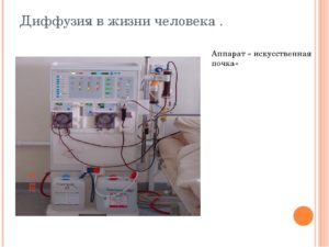 Применение диффузии в медицине аппарат искусственная почка