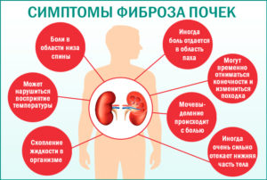 Могут ли почки болеть без боли