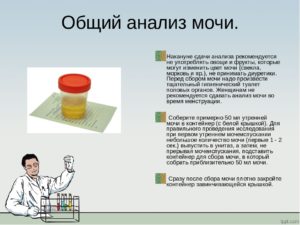 Полный анализ мочи как собирать