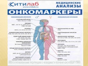 Онкомаркеры почек какие